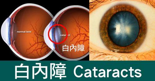 北京宁联西海眼科医生团队实力强大及骨干医生简介