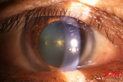 蒙城县第一人民医院眼科特色项目及技术优势