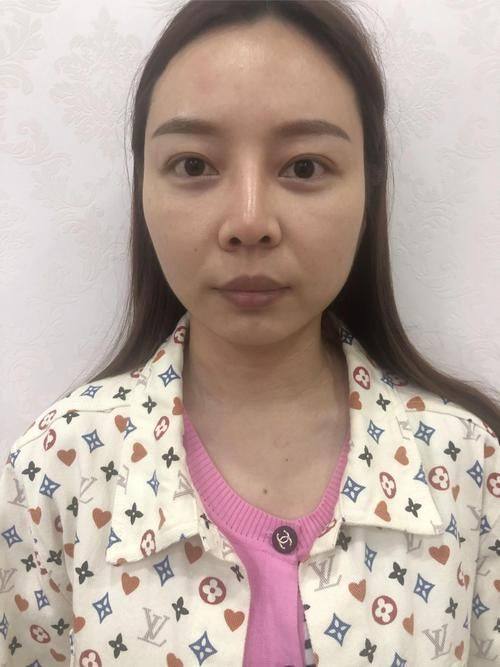 绍兴瑞金医院整形美容中 心特色项目及技术优势