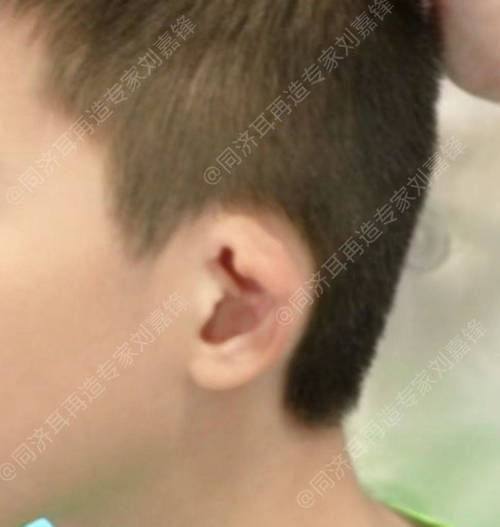 长春京典医疗美容门诊真人口碑评价怎么样?