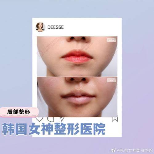 大连春柳整形医疗美容诊所真人口碑评价怎么样?