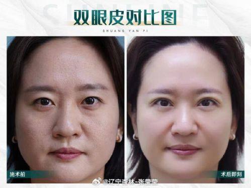 大连春柳整形医疗美容诊所地址电话营业时间