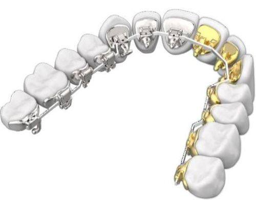 东莞华益口腔门诊部收费价格表/收费标准