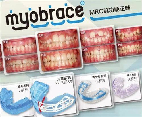 冉超医生擅长项目