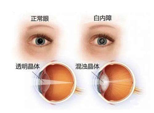 兰州爱尔眼科医院有限公司详细的预约挂号方式及流程