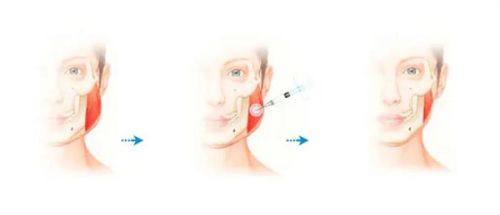 北京瑞鑫创美医疗美容诊所真人口碑评价怎么样？