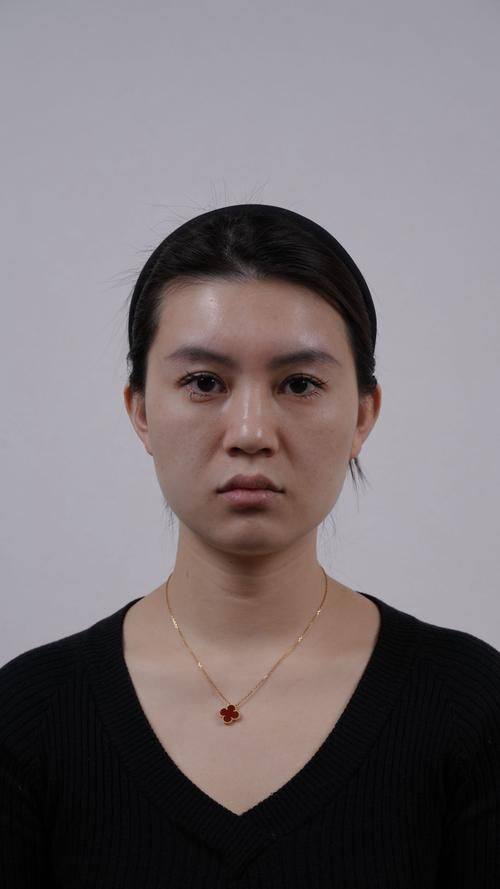 厦门佰蓓医林医疗美容门诊部真人口碑评价怎么样？