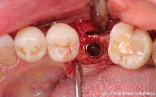 孙亮医生技术优势