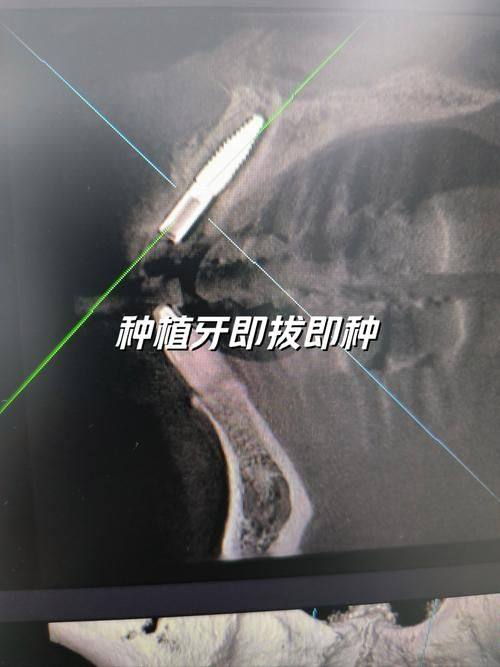 口碑评价及真人实例