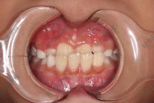 铂灵口腔矫正种植中 心（东航店）详细的预约挂号方式及流程