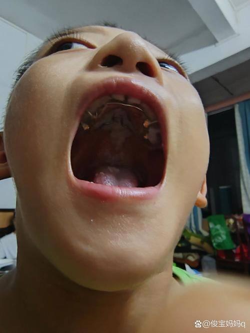 铂灵口腔矫正种植中 心（东航店）地址电话营业时间