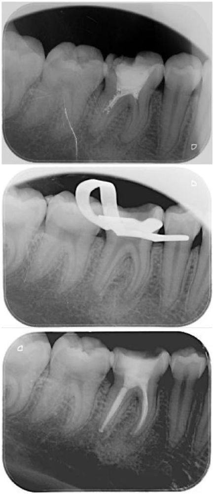 湖南株洲美迪口腔收费价格表/收费标准