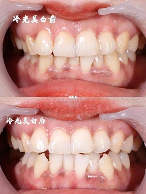 重庆美维口腔医院详细的预约挂号方式及流程