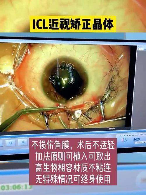 绥化北医眼科视光中 心(老市医院店)特色项目及技术优势