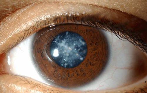 张桂阳医生擅长项目