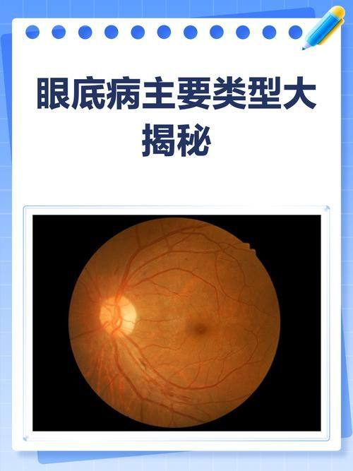 兰州爱尔眼科医院有限公司地址电话营业时间