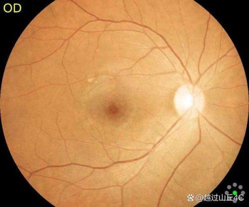 大石桥爱尔眼科医院特色项目及技术优势