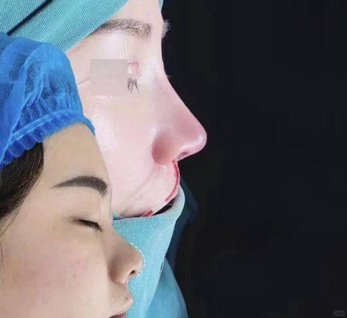 合肥申诚整形美容医院是正规医院吗？