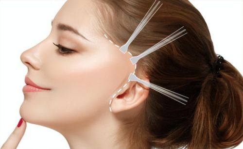 韩国Trophy皮肤科是正规医院吗？