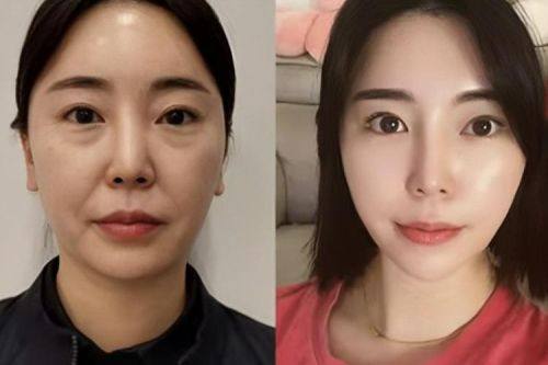 韩国Trophy皮肤科真人口碑评价怎么样？