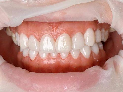 湖南株洲美迪口腔特色项目及技术优势