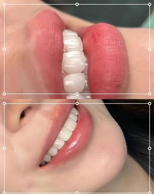 重庆美维口腔医院特色项目及技术优势