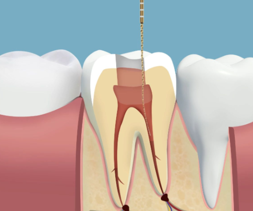 兰晓莉医生口碑评价及真人实例