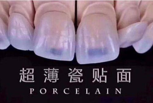 口碑评价及真人实例