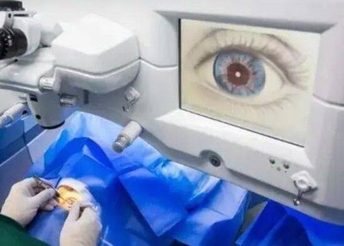 临沂兰山麦迪格眼科诊所真人口碑评价怎么样？