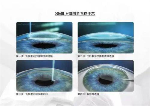 临沂兰山麦迪格眼科诊所特色项目及技术优势