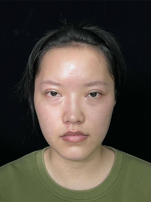 开封誉美医疗美容诊所特色项目及技术优势