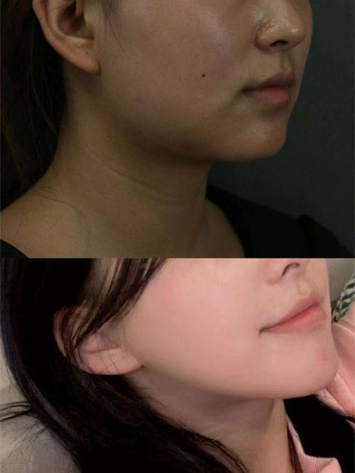 韩国李斗荣美笑整形外科特色项目及技术优势