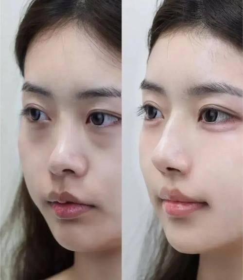 广州雅度整形医院是正规医院吗？