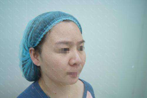 广州雅度整形医院详细的预约挂号方式及流程