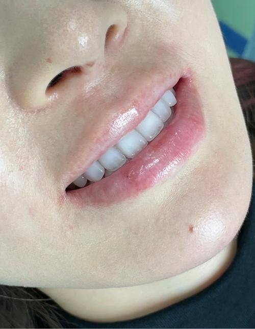 安徽蚌埠市彭氏永康口腔收费价格表/收费标准