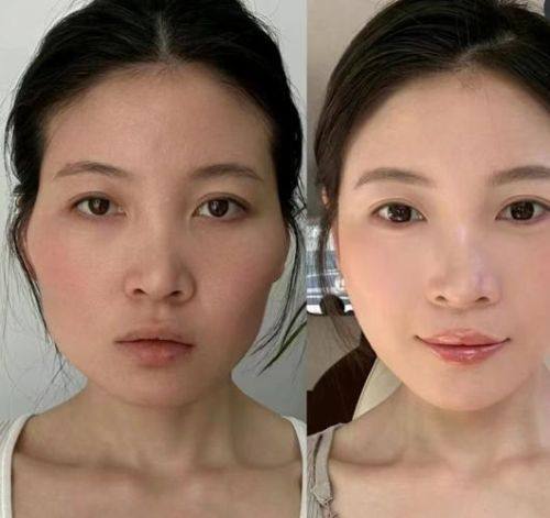 陈静医生技术优势