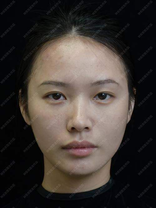 陈静医生预约挂号