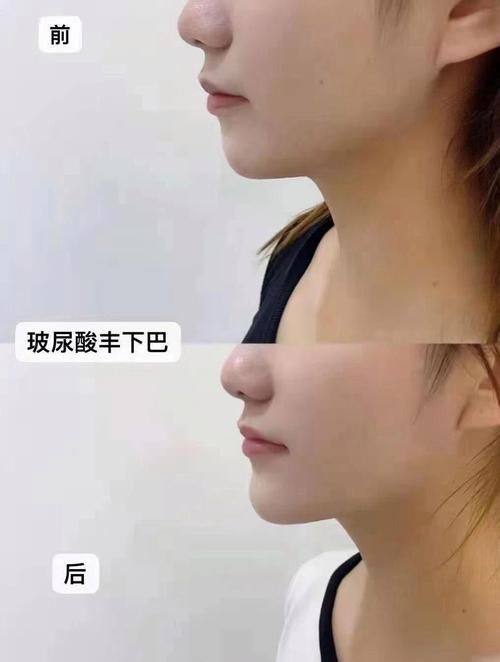 陈静医生擅长项目