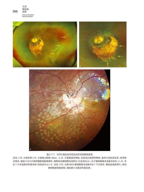 广州黄埔爱尔眼科医院有限公司收费价格表/收费标准