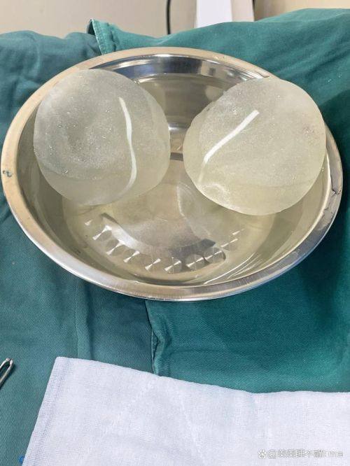 韩国李斗荣美笑整形外科是正规医院吗?