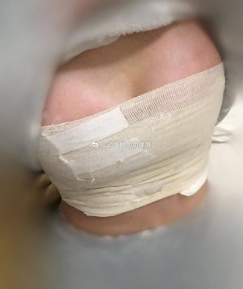 徐州华美整形医院特色项目及技术优势