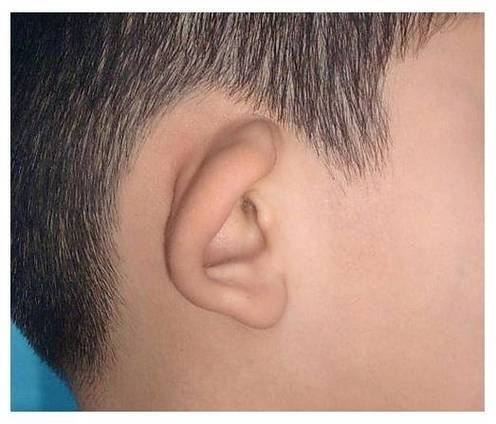 开封誉美医疗美容诊所是正规医院吗？