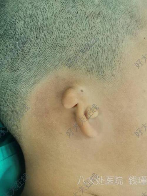 武汉仁爱合美(素妈颜)医疗美容医院是正规医院吗?