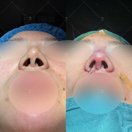 西安多丽斯医疗美容诊所收费价格表/收费标准