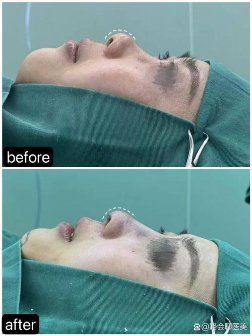 西安多丽斯医疗美容诊所详细的预约挂号方式及流程