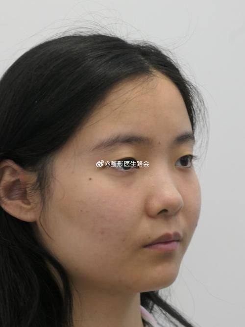 韩国李斗荣美笑整形外科详细的预约挂号方式及流程