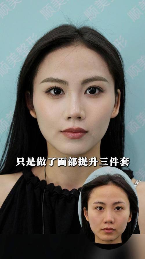 徐州华美整形医院医生团队实力强大及骨干医生简介