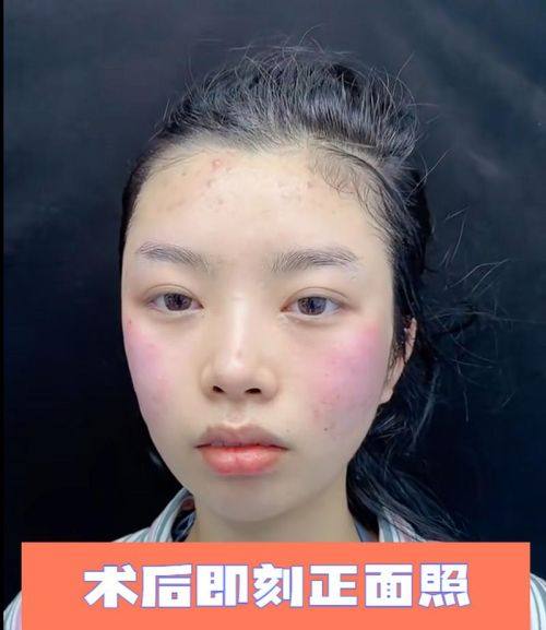 广州雅度整形医院收费价格表/收费标准