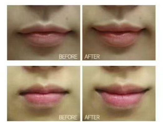 武汉仁爱合美(素妈颜)医疗美容医院真人口碑评价怎么样?