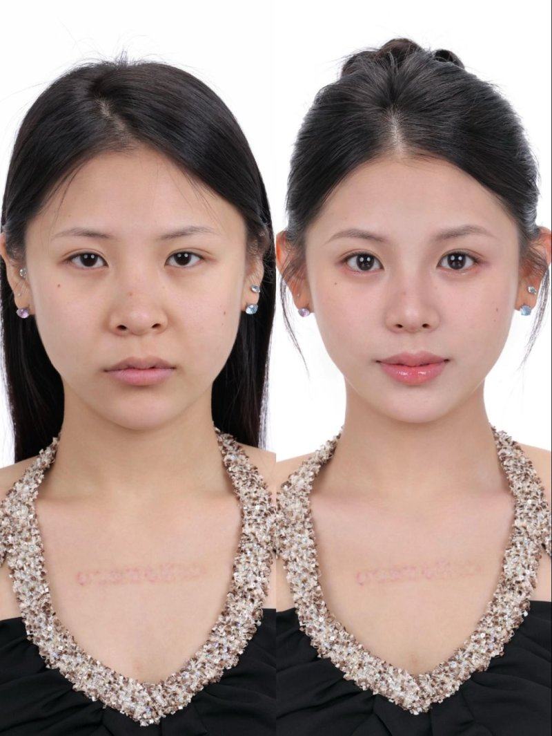 开封誉美医疗美容诊所收费价格表/收费标准